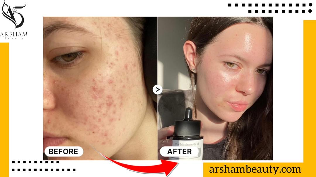 سرم نیاسینامید کوزارکس Cosrx