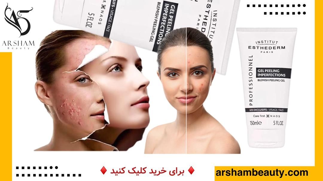ژل پیلینگ ایمپرفکشن استادرم ESTHEDERM